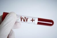 Ilustrasi (Getty Images/iStockphoto/atakan)