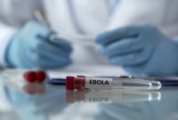 Ilustrasi ebola(Foto: shutterstock)