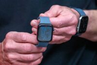 Apple Watch 11 (David Paul Morris/Bloomberg)