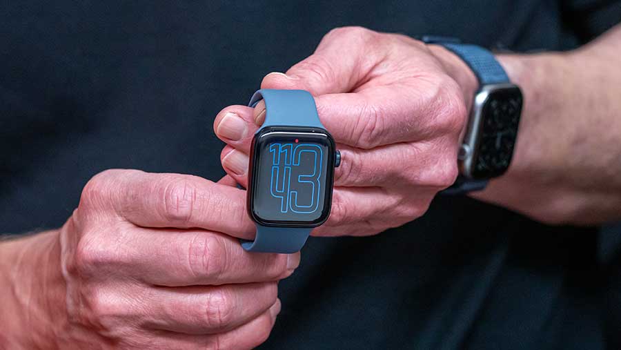 Apple Watch 11 (David Paul Morris/Bloomberg)